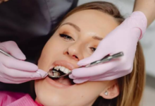 How Do Dental Implants Support Better Jawbone Health Over Time?